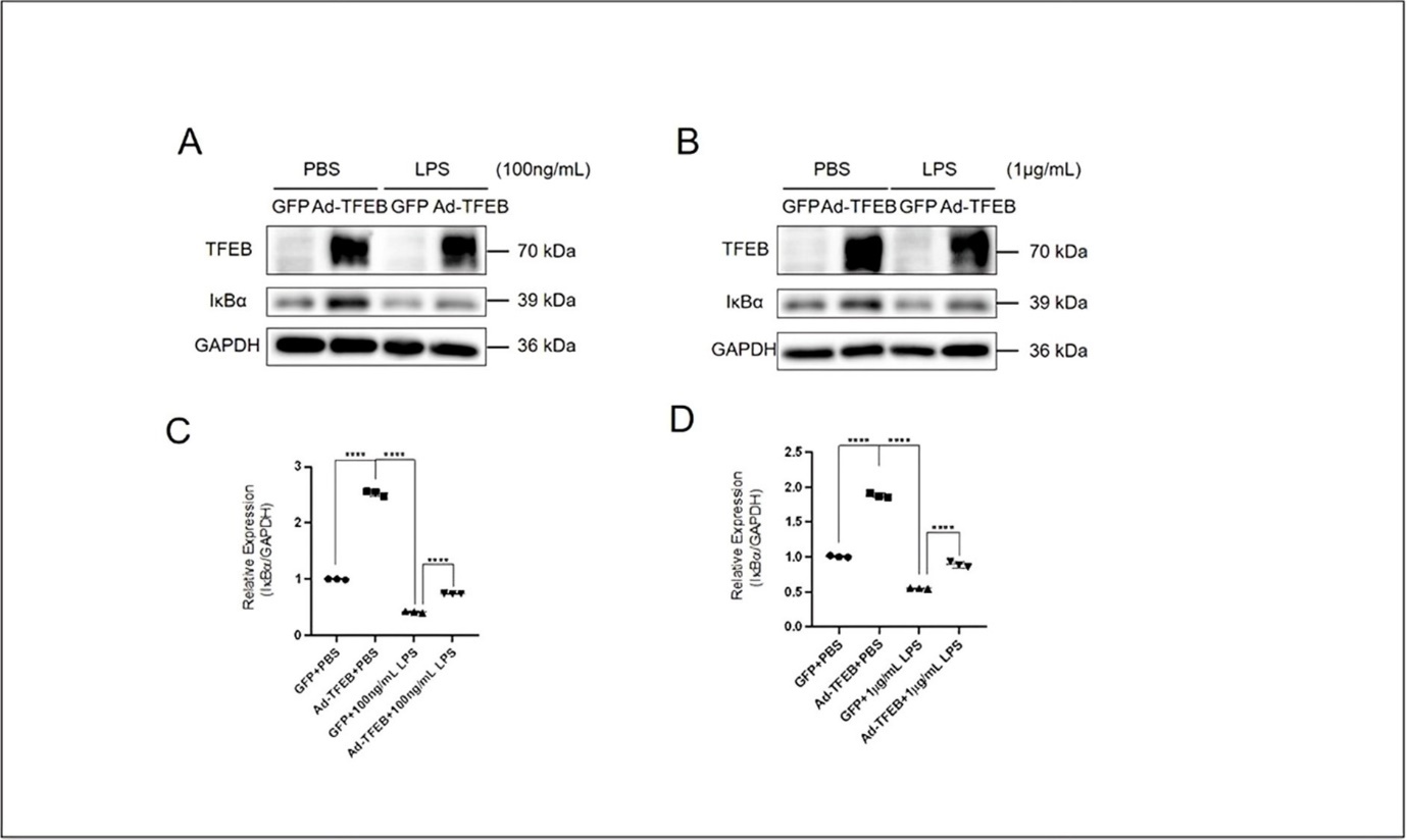 TFEB restores the expression of IκBα. (A) Western blotting results showing the LPS- (100 ng/mL, 30 min) induced changes of protein expression levels of TFEB and IκBα in HaCaT cells pretreated with Ad-TFEB for 24 h. (B) Western blotting results showing the LPS- (1 μg/mL, 30 min) induced changes of protein expression levels of TFEB and IκBα in HaCaT cells pretreated with Ad-TFEB for 24 h. Summarized western blotting results were analyzed using Image J to show the level of IκBα exposed to (C) LPS- (100 ng/mL, 30 min) and (D) LPS- (1 μg/mL, 30 min). Data was analyzed using two-way ANOVA, *P<0.05,**P<0.01,***P< 0.001,****P<0.0001.
